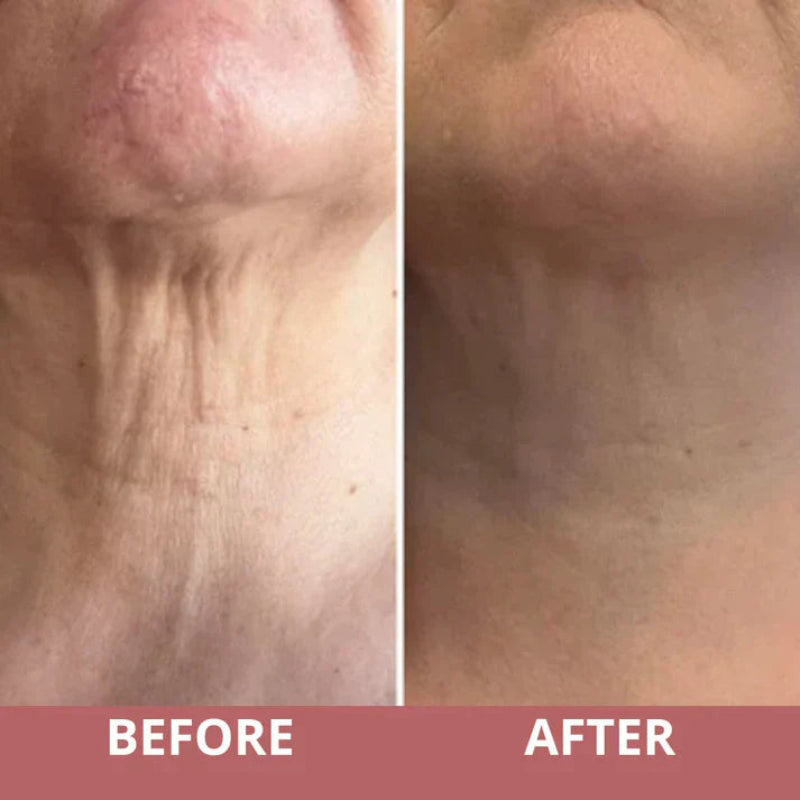 Neck Firming Cream with Roller Applicator | Anti-Aging Moisturizer with AH-8 & Ceramides | 50ml