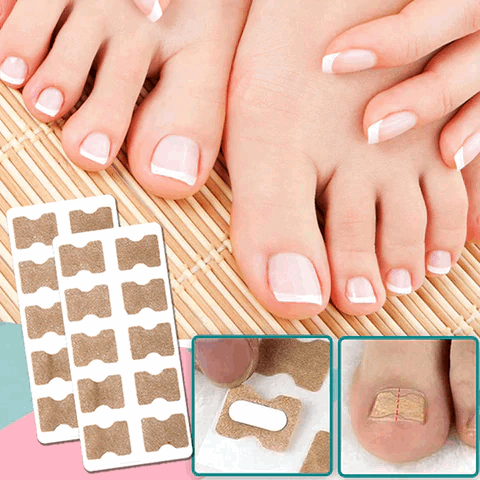 (50% Discount) FinePatches™ | Correction Patches for Beautiful and Healthy Nails