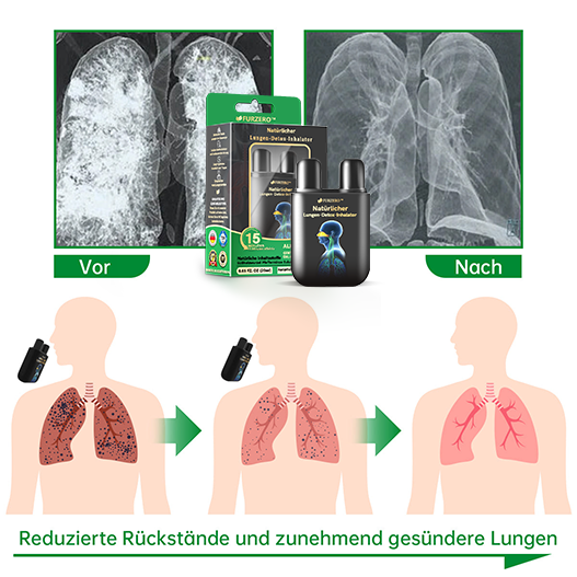 PureBreathe™ Natural Lung Refresh