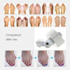 (1+1 FREE) Bunion Relief Splint