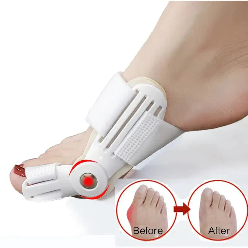 (1+1 FREE) Bunion Relief Splint