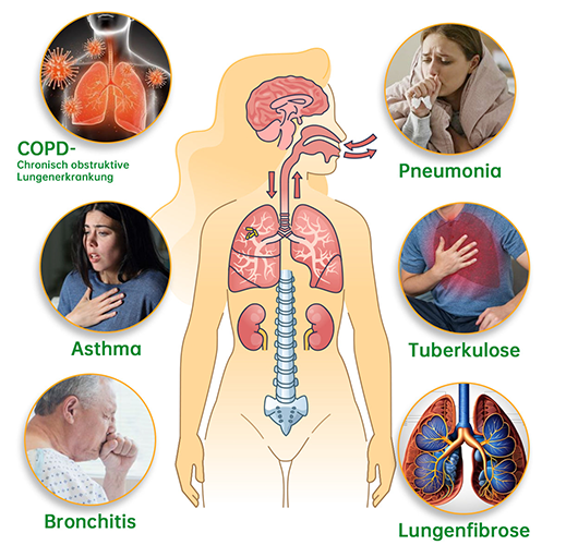 PureBreathe™ Natural Lung Refresh