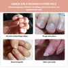 Nail Repair Oil | Moisturizing & Strengthening Formula | Vitamin-Enriched | 30ml