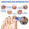 PureNail™ | Nail Fungus Laser Therapy Device - Your Secret Weapon Against Nail Fungus