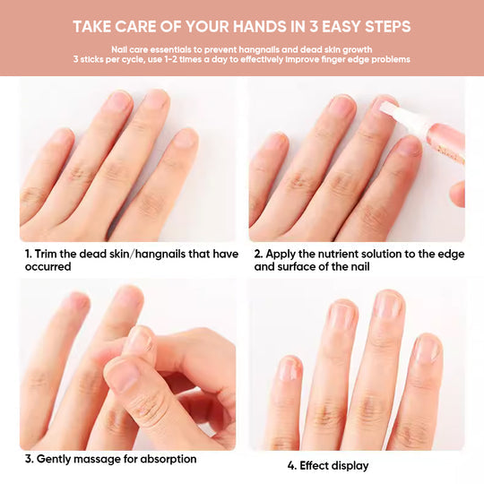 Nail Repair Oil | Moisturizing & Strengthening Formula | Vitamin-Enriched | 30ml