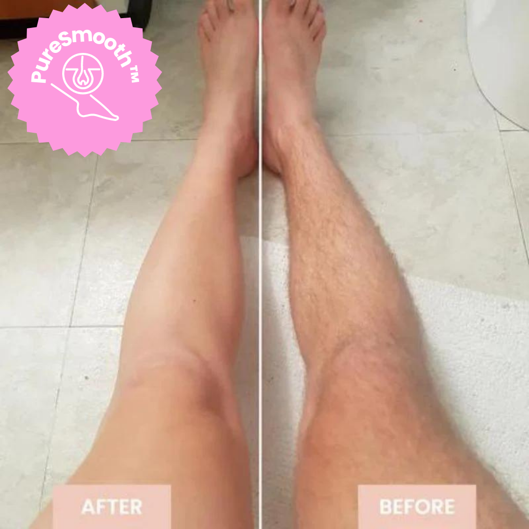 SmoothGlide™ Effortless Hair Removal