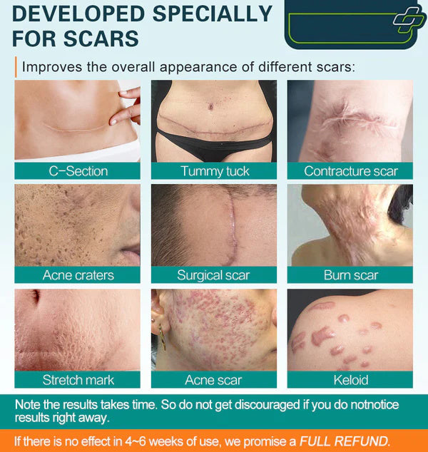 ScarFix™ Scar-Free Confidence Boost