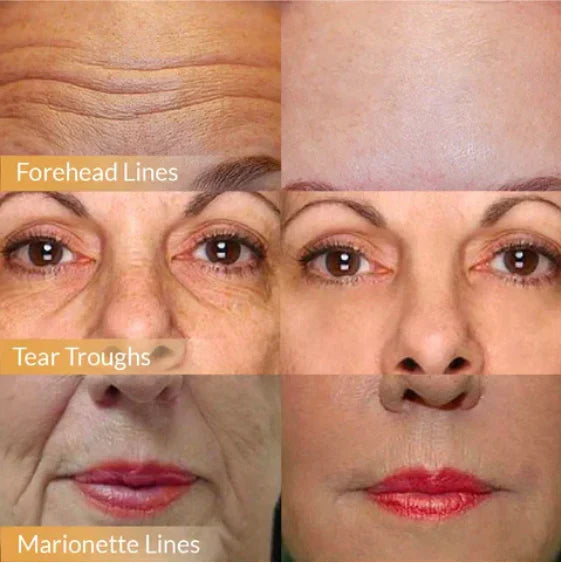 Anti-Aging Face Cream | Lifting & Firming | Hydrating with Ginseng & Pomegranate