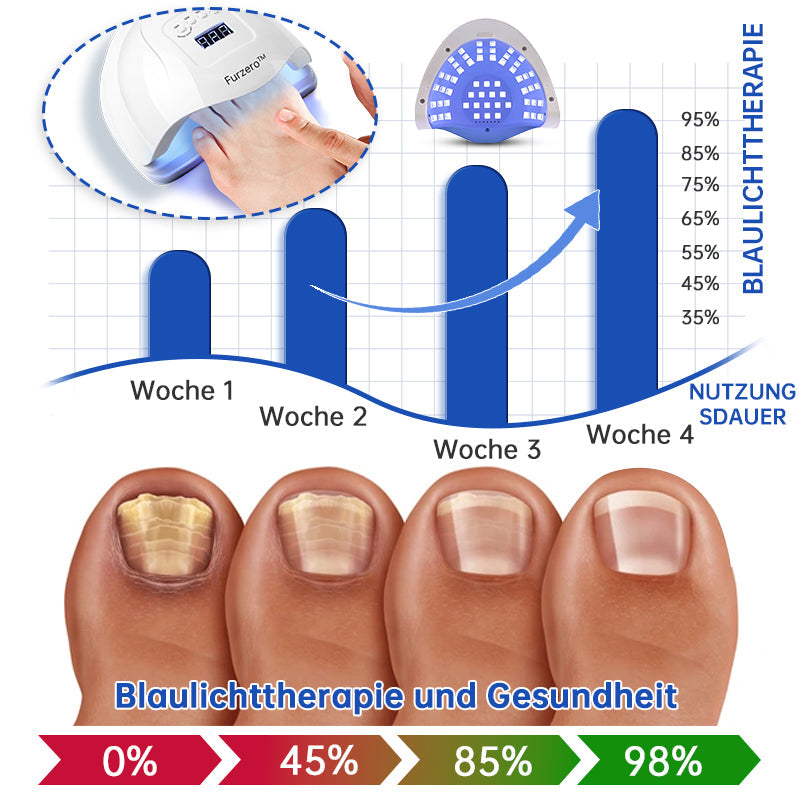 PureNail™ | Nail Fungus Laser Therapy Device - Your Secret Weapon Against Nail Fungus