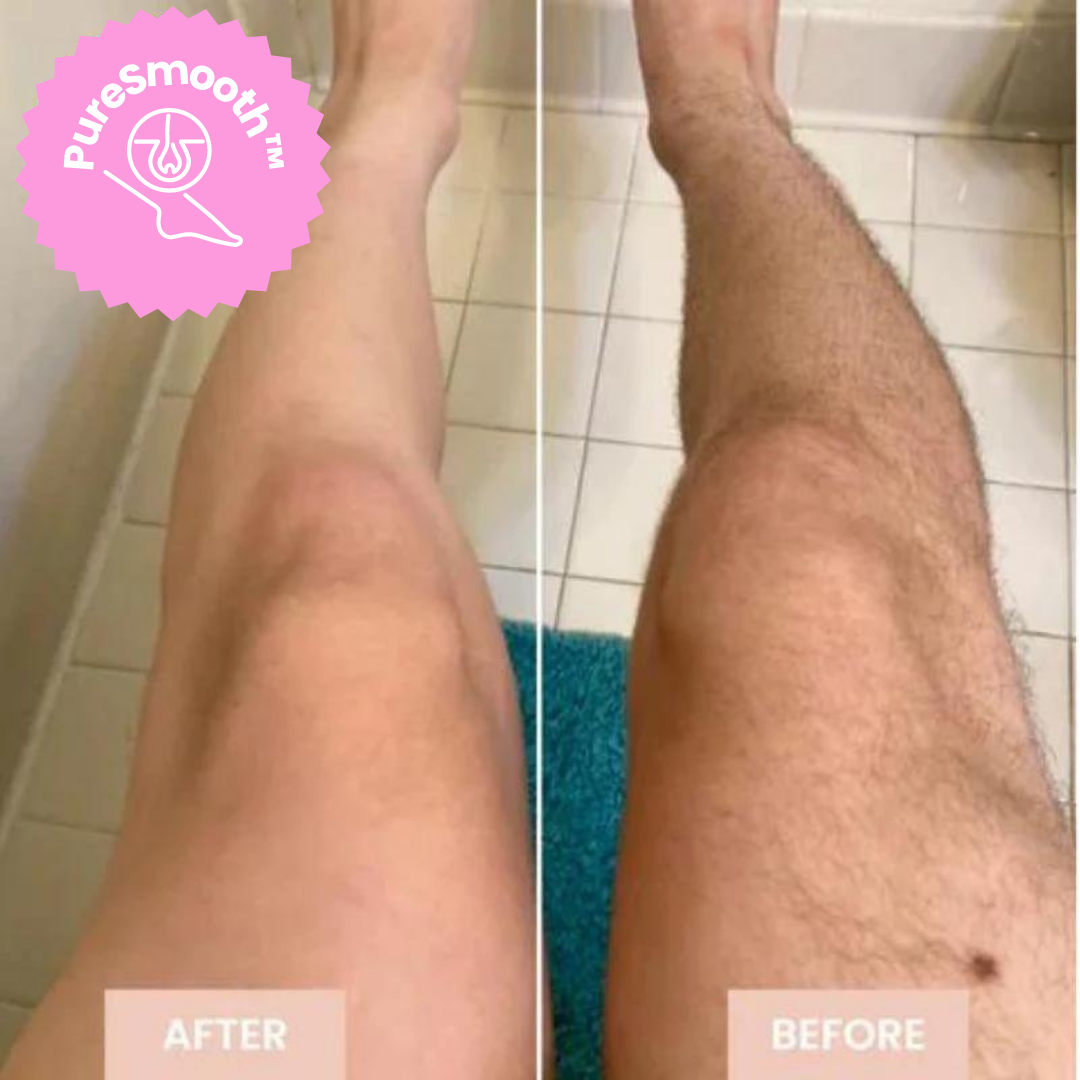 SmoothGlide™ Effortless Hair Removal