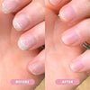 Nail Repair Oil | Moisturizing & Strengthening Formula | Vitamin-Enriched | 30ml
