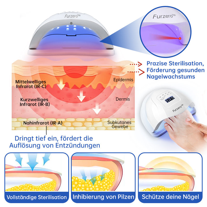 PureNail™ | Nail Fungus Laser Therapy Device - Your Secret Weapon Against Nail Fungus