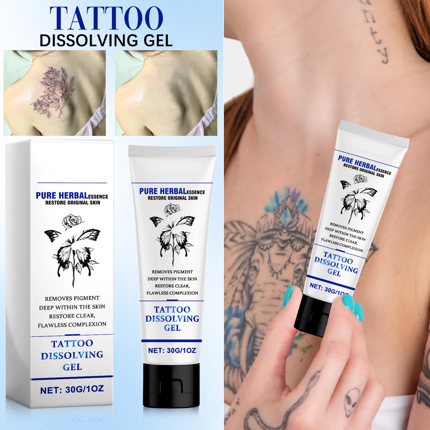 1+1 Free | TattooGone™ Easy Tattoo Erasure