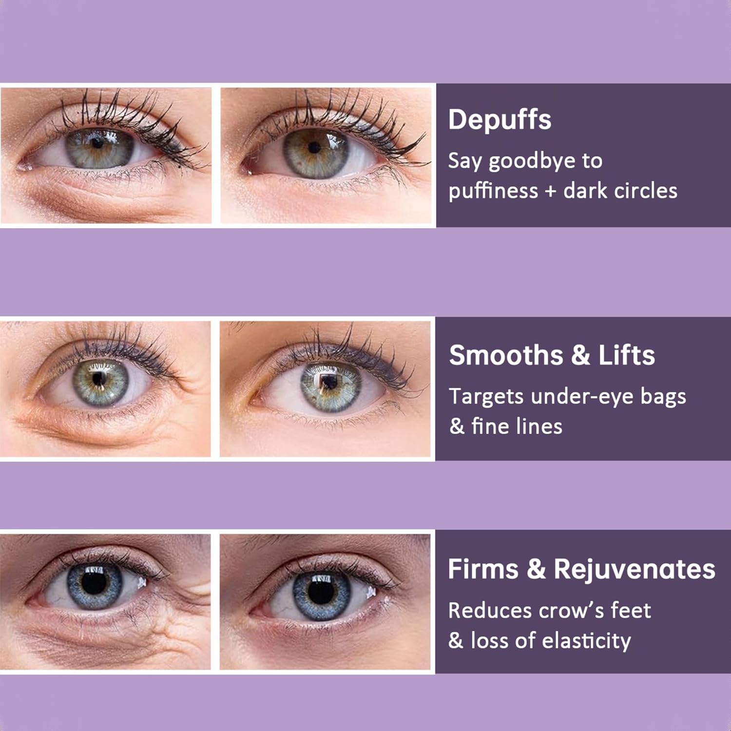 Eye Tightening Cream | Instant Firming & Brightening Formula | Reduces Puffiness & Wrinkles | 15ml