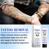 1+1 Free | TattooGone™ Easy Tattoo Erasure