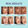 DewBlend™ Hide Blemishes Instantly
