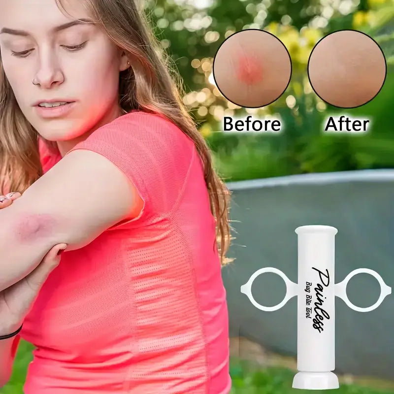 Insect Bite Relief Device | BiteAway™ Instant Itch & Sting Soother | Medical-Grade Silicone | 2+2 Free Set