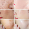 MatteBlur™ Poreless Skin Perfection Instantly