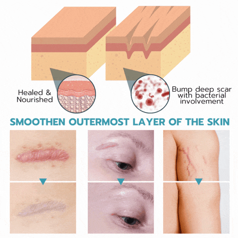 Reusable Anti-Wrinkle Face Patches | Silicone Wrinkle Pads for Forehead, Eyes & Smile Lines