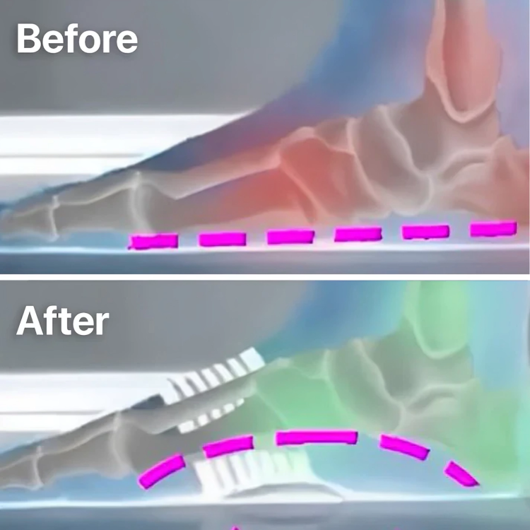 1+1 Free | StepComfort™ Soothing Foot Relief