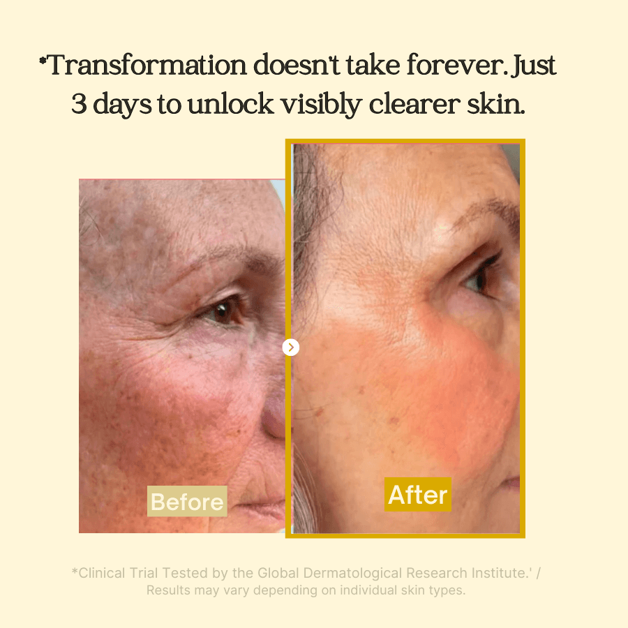 Dark Spot Corrector Face Mask | Overnight Peel-Off Brightening Treatment | 30ml