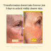 Dark Spot Corrector Face Mask | Overnight Peel-Off Brightening Treatment | 30ml
