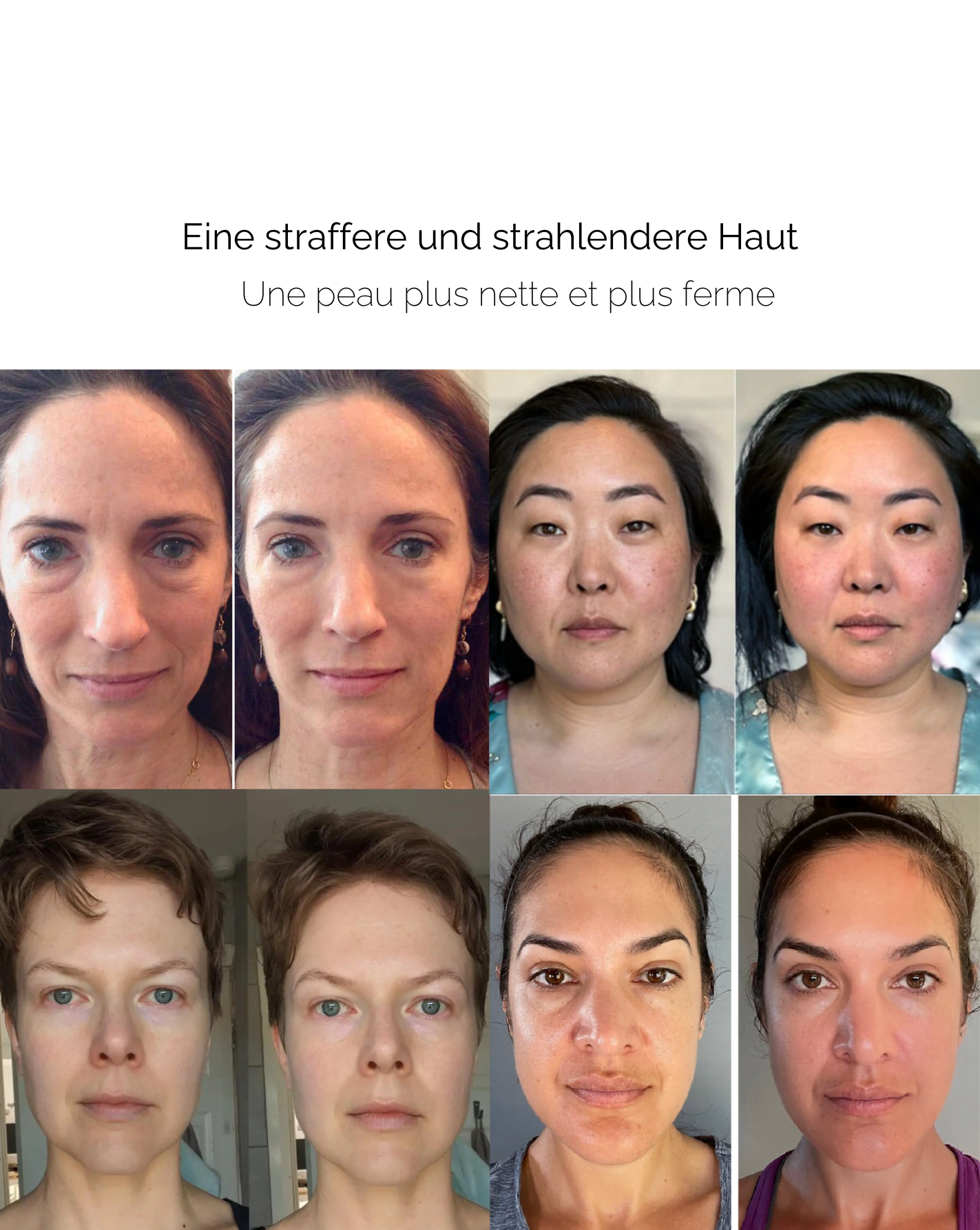 LuxeRoller™ Rejuvenate From Within