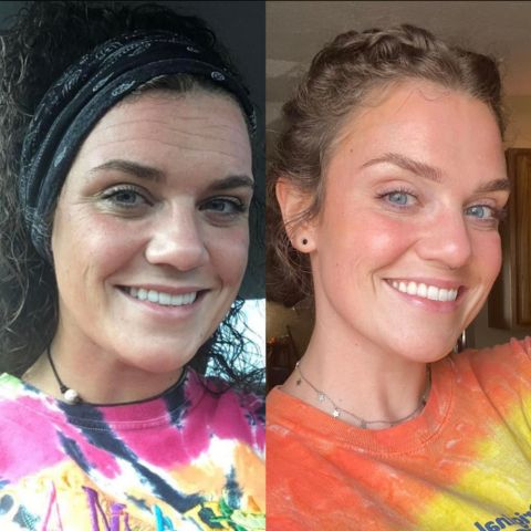 Reusable Anti-Wrinkle Face Patches | Silicone Wrinkle Pads for Forehead, Eyes & Smile Lines