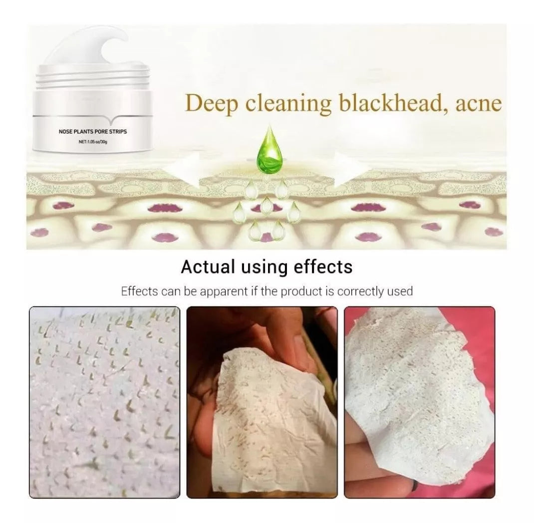 Pore Cleansing Strips with Aloe Vera & Charcoal | Blackhead Removal | 30g Gel + 60 Strips