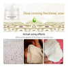 Pore Cleansing Strips with Aloe Vera & Charcoal | Blackhead Removal | 30g Gel + 60 Strips