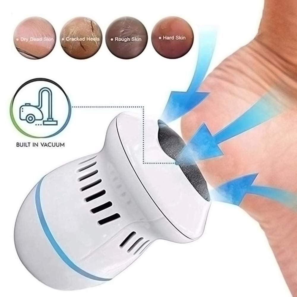 GlattFuß™ Foot Care - Electric Callus Remover