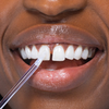 SmileGloss™ Instant Bright Teeth Effect