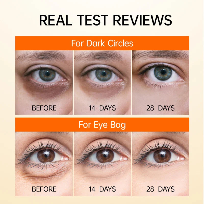 RadiantEyes™ Refresh & Revitalize Eyes