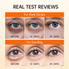 RadiantEyes™ Refresh & Revitalize Eyes