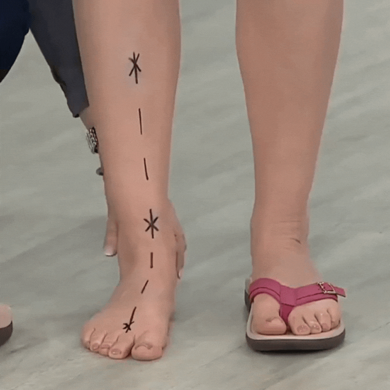 Pylomo's Orthopedic Summer Sandals (50% Discount)