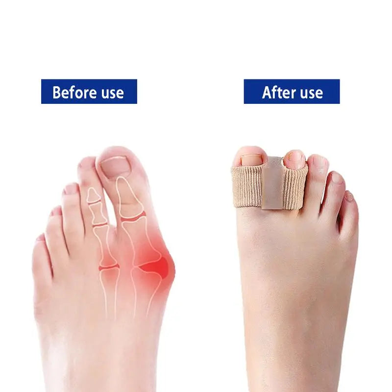 Toe Separators for Bunions & Misalignment | Elastic Nylon + SEBS | Pain Relief & Posture Support