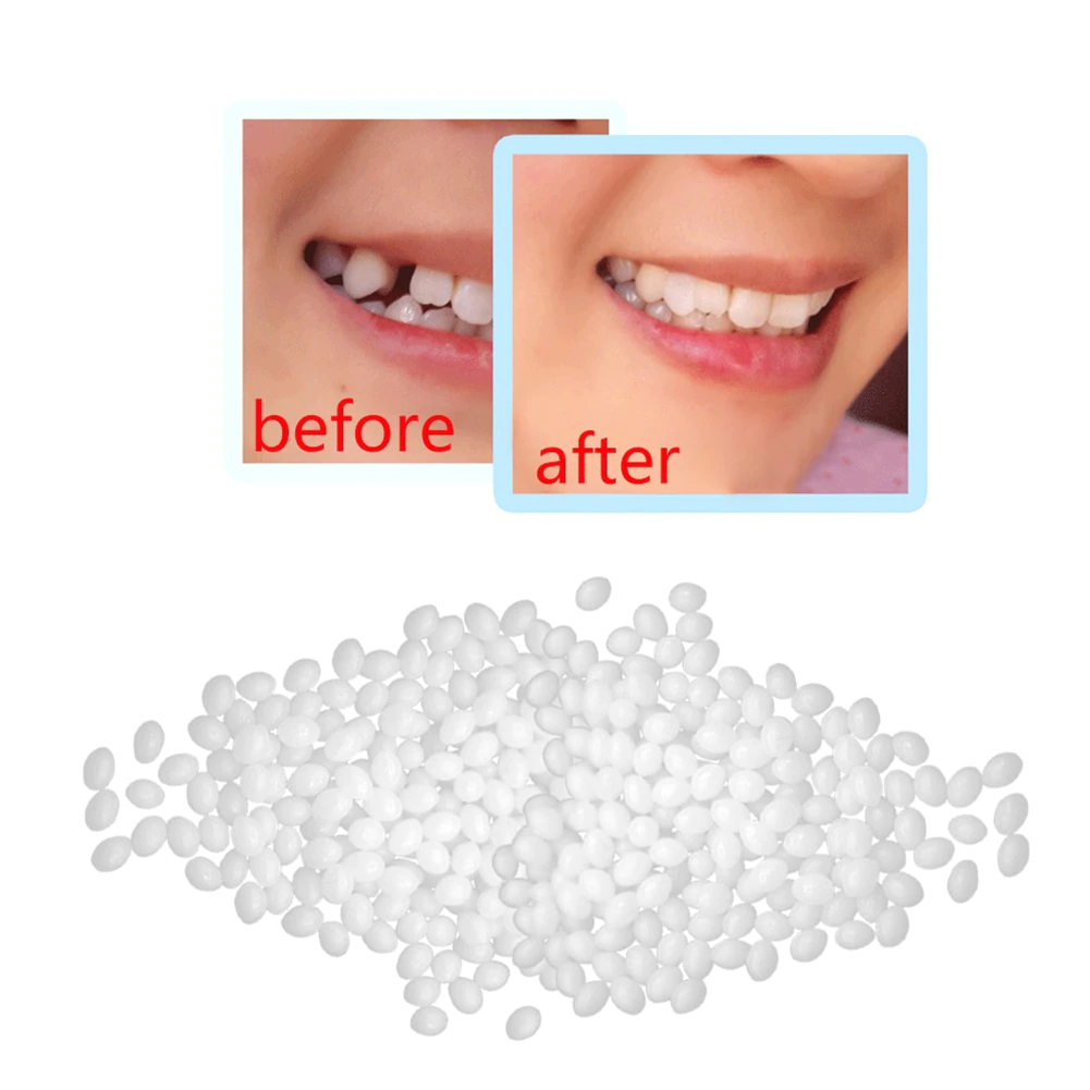 Fresh Smile™ DIY Tooth Repair Kit