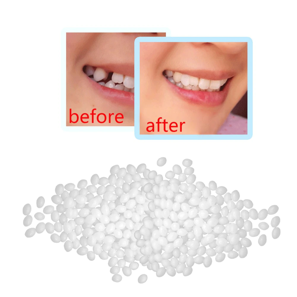 1+1 Free | DIY Tooth Repair Kit™ - Get the Perfect Smile in Seconds!