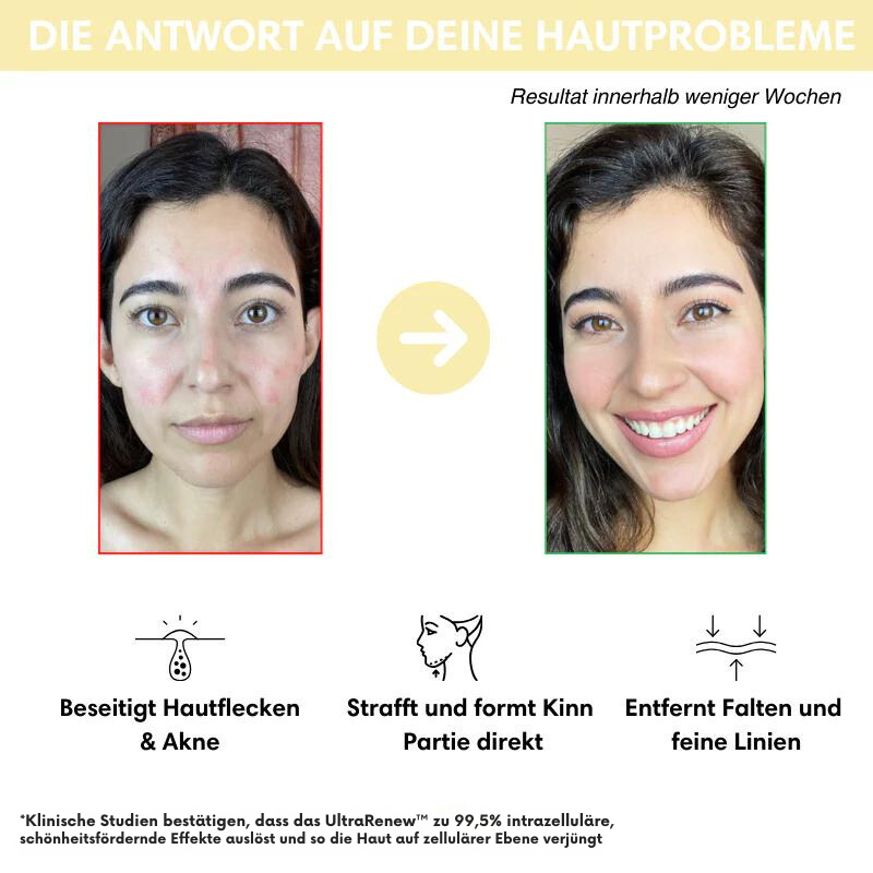 UltraRenew™ - Youthful Appearance in Just 10 Minutes
