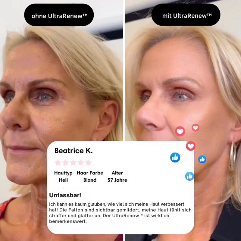 UltraRenew™ - Youthful Appearance in Just 10 Minutes