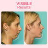 FaceSuction™ Enhanced Facial Definition