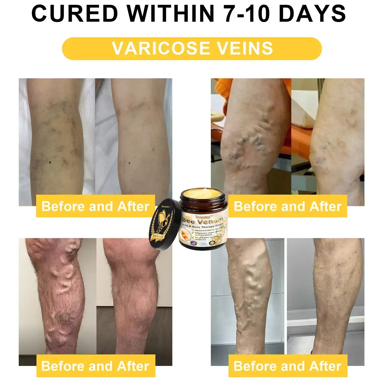 BeeTherapy™ Natural Healing Cream in just 4 Weeks