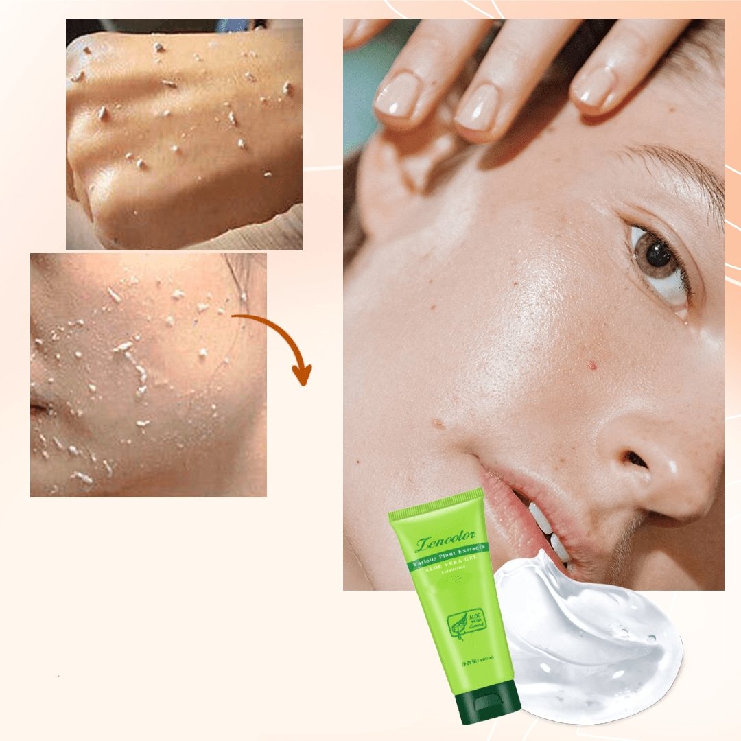 Aloe Exfoliating Gel