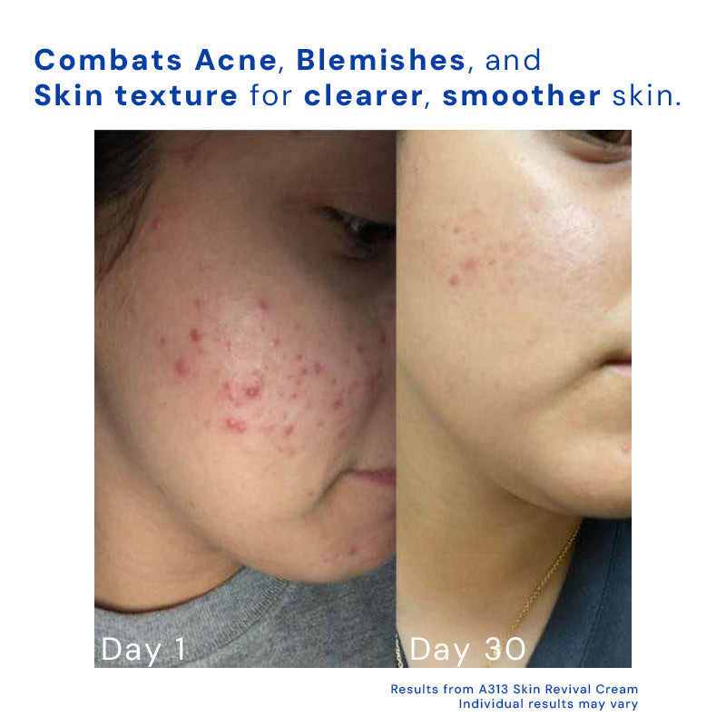 Anti-Aging Night Cream | Retinyl Palmitate & Vitamin A | Smooth Wrinkle Repair | Hydrating Formula