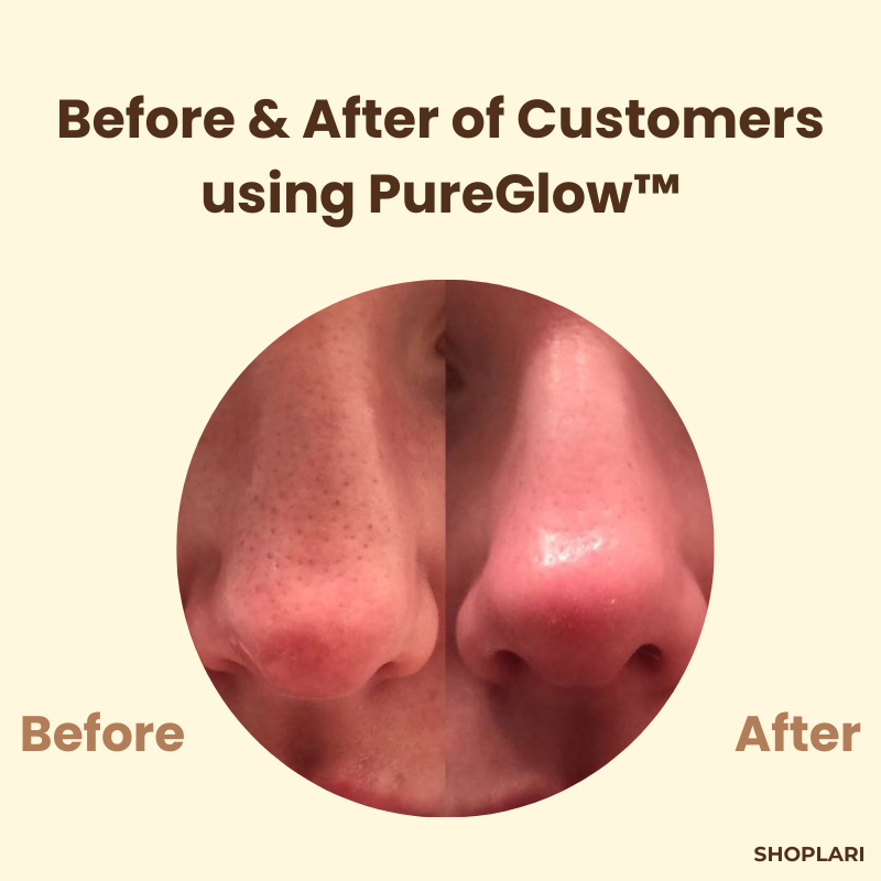 TeaTherapy™ Soothing Skin Relief in just Few Weeks
