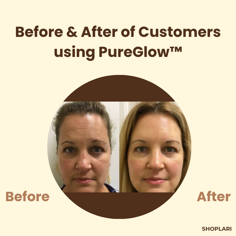 TeaTherapy™ Soothing Skin Relief in just Few Weeks