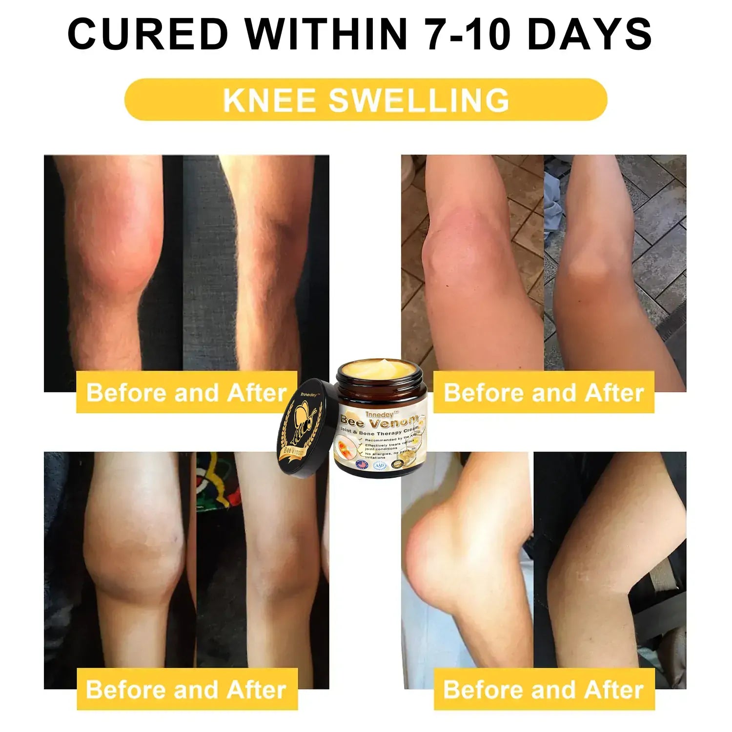 BeeTherapy™ Natural Healing Cream in just 4 Weeks