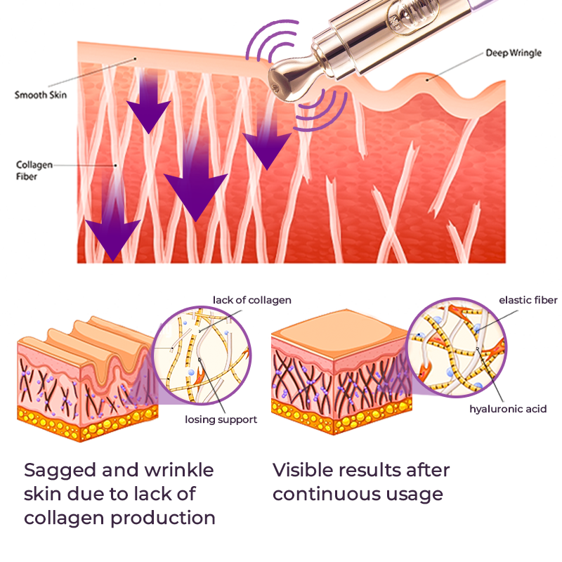 GlowPen™ Flawless Radiance Effect