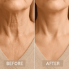 Neck Lifting Tape | Instant Firming & Sculpting Effect | Invisible & Skin-Safe Adhesive