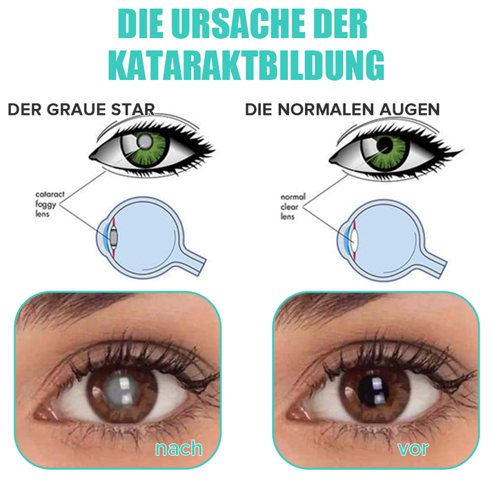 VisionDew™ Refreshes Tired Eyes